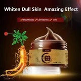 Whitehead Deep Cleansing Acne Mask