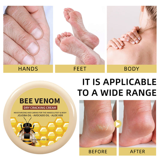 Moisturizing Hand And Foot Cream To Hydrate And Prevent Dryness In The Skin On Your Heels