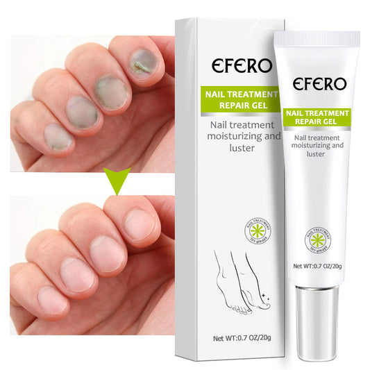 Nail Gel Nail Liquid Plant Nail Liquid