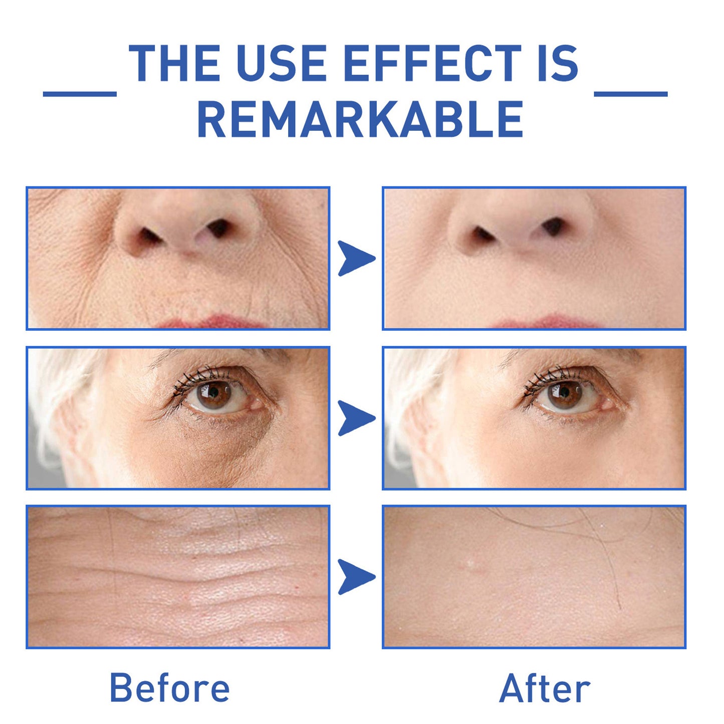 Water Light Cone Shell Peptide Anti-wrinkle