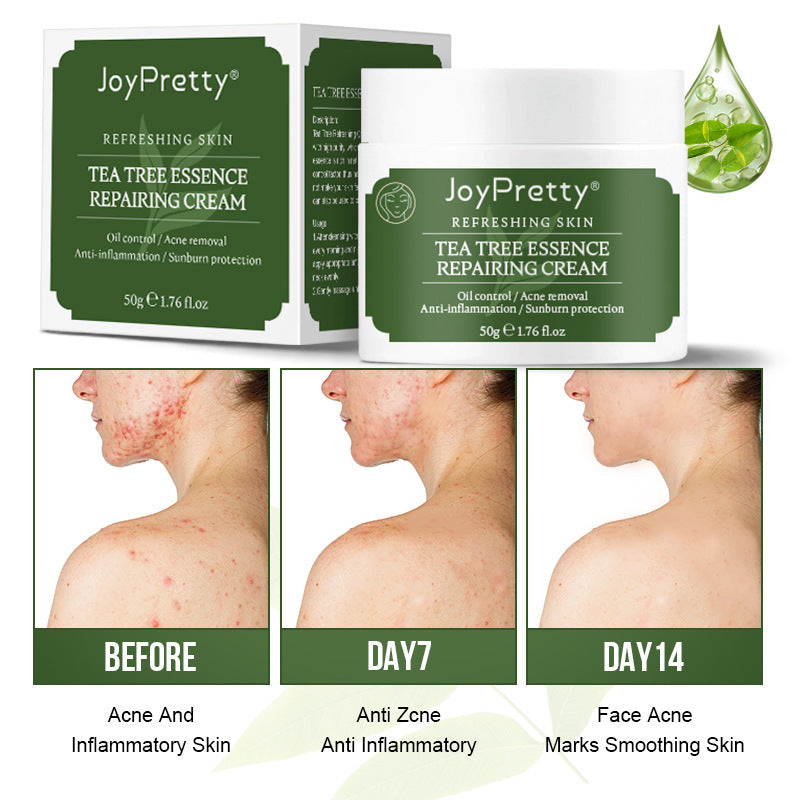 Tea Tree Oil Control Acne Moisturizing Moisturizing Cream
