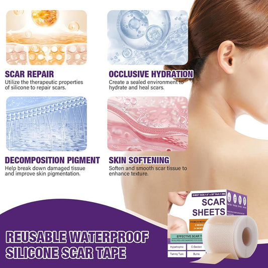 Scar Paster Silicone Scar Sheets15 M Length Soothing