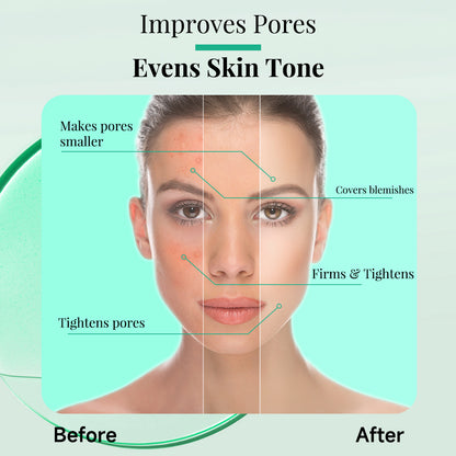 Tea Tree Removing Acne Liquid Female Desalination
