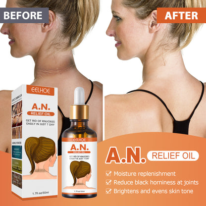 Blackening And Whitening Essential Oil Arm Armpit Joint