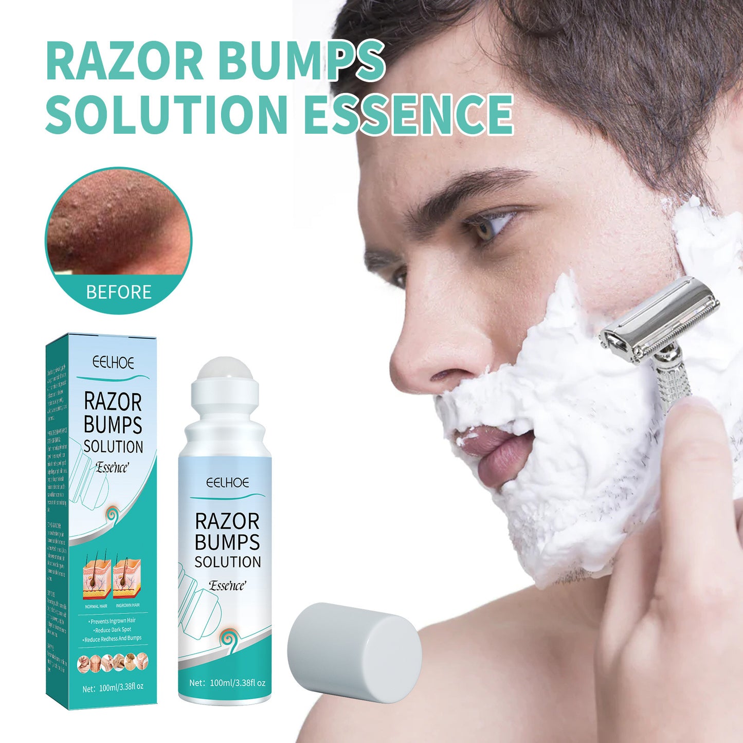 Pogonotomy Lump Repair Ball Repair Skin Pimple Prevent Hair Ingrowth