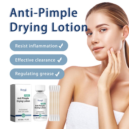 Hoygi Anti-Pimple Drying Lotion, Facial Cleansing And Repair Lighten Acne Marks And Pits, Close Your Mouth And Mild Skin Cream