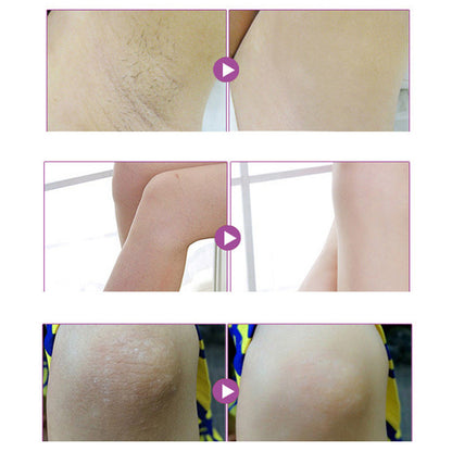 Aichun repair whitening black pigment to prevent odor, sweat to smell, armpit whitening skin 50g