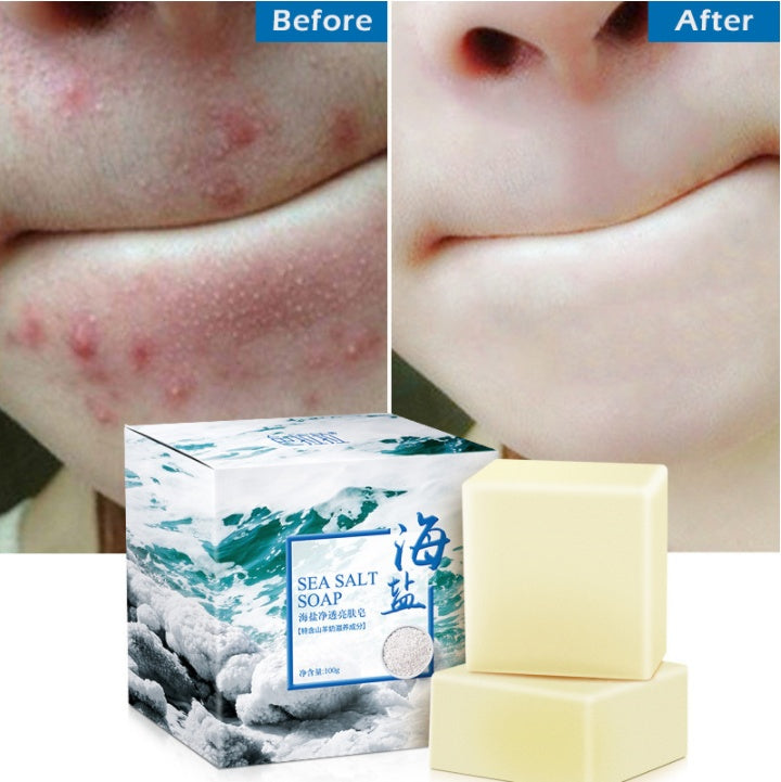 Natural Sea Salt Goat Milk Handmade Soap In Addition To Mites And Whitening Essential Oil Soap Factory Direct Live Broadcast Wechat