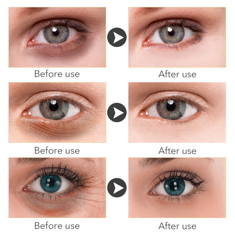 OMY LADY Instant Remove Eye bags Cream Anti Puffiness Gel Dark Circles Delays aging fades wrinkles Firming Brighten Skin Unisex