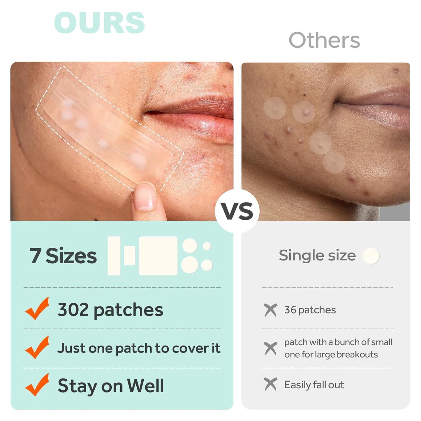 Acne Cover Patch Mild Desalting PIMPLE Acne Closed Mouth