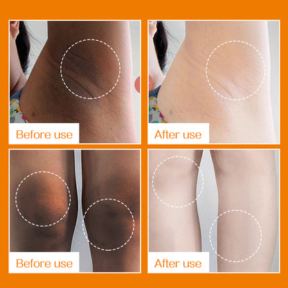 Gongpei Underarm Light Black And Tender White Cream 60g