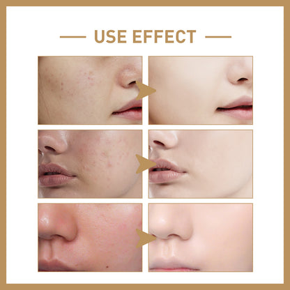 EELHOE Rice Lotion Deep Hydrating Repair Skin Barrier