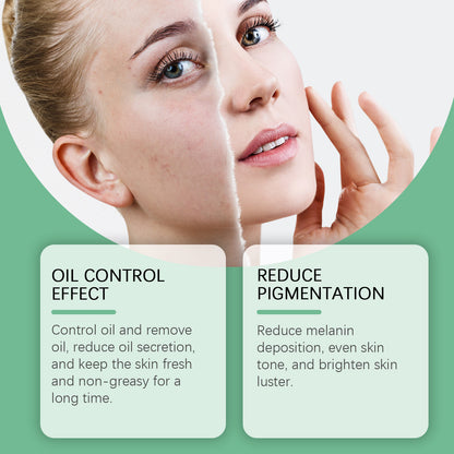 West&Month Azelaic Acid Essence Cream, Repair Moisturizing Moisturizing Face Oil Control Moisturizing Mild Refreshing Cream