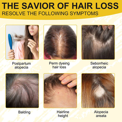 Rice Water Sheng Jiang Wang Hair Nutrient Solution Anti-shedding