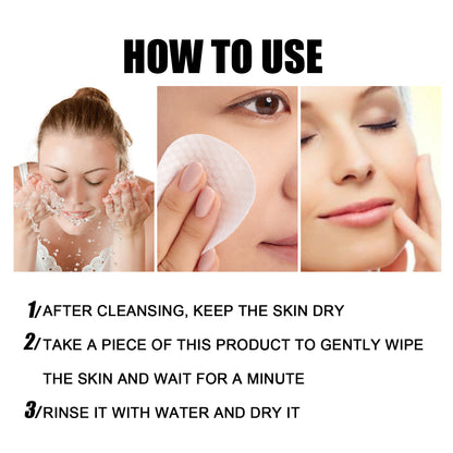 Hoygi Detox Pads, Mildly Remove Blackheads Silence Is Exquisite Moist Bright Skin Pores