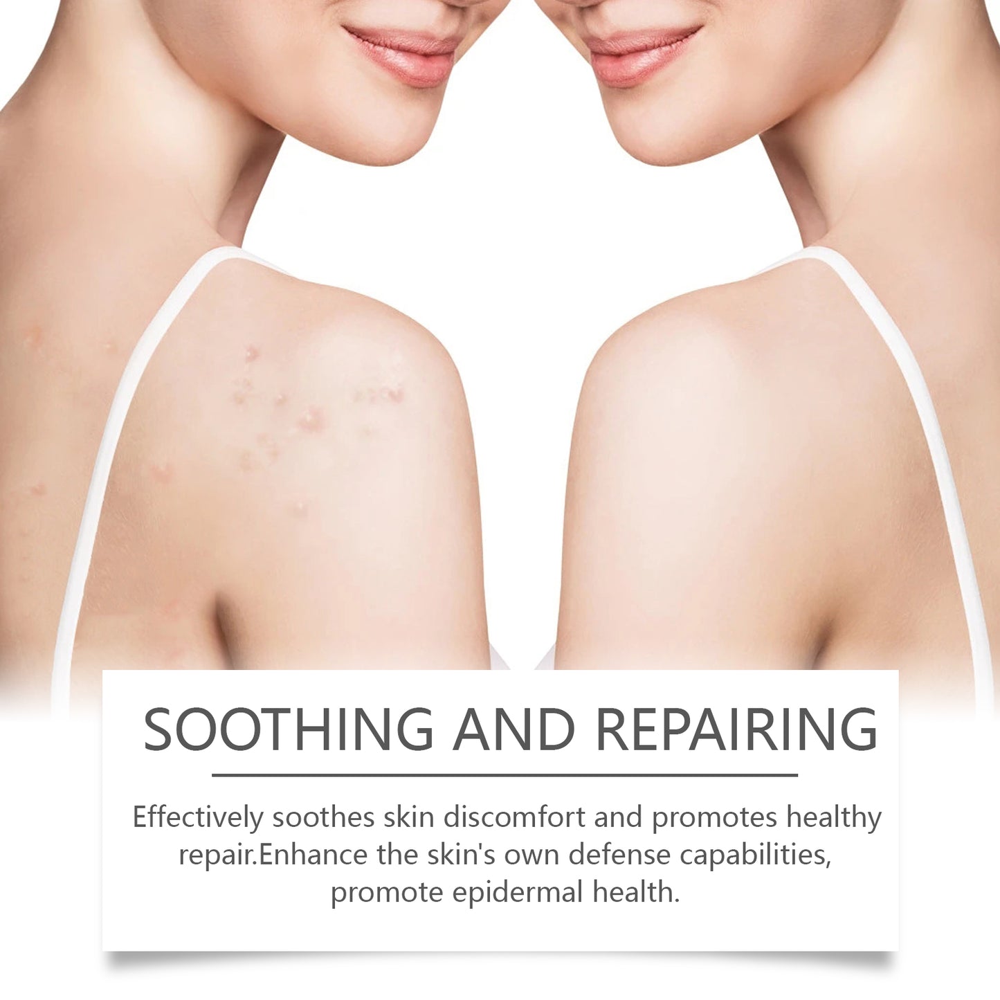 Hoygi Centella Asiatica Skin Cream, With Its Gentle Plant Ingredients, Nourishes The Skin And Gives It A Radiant Glow