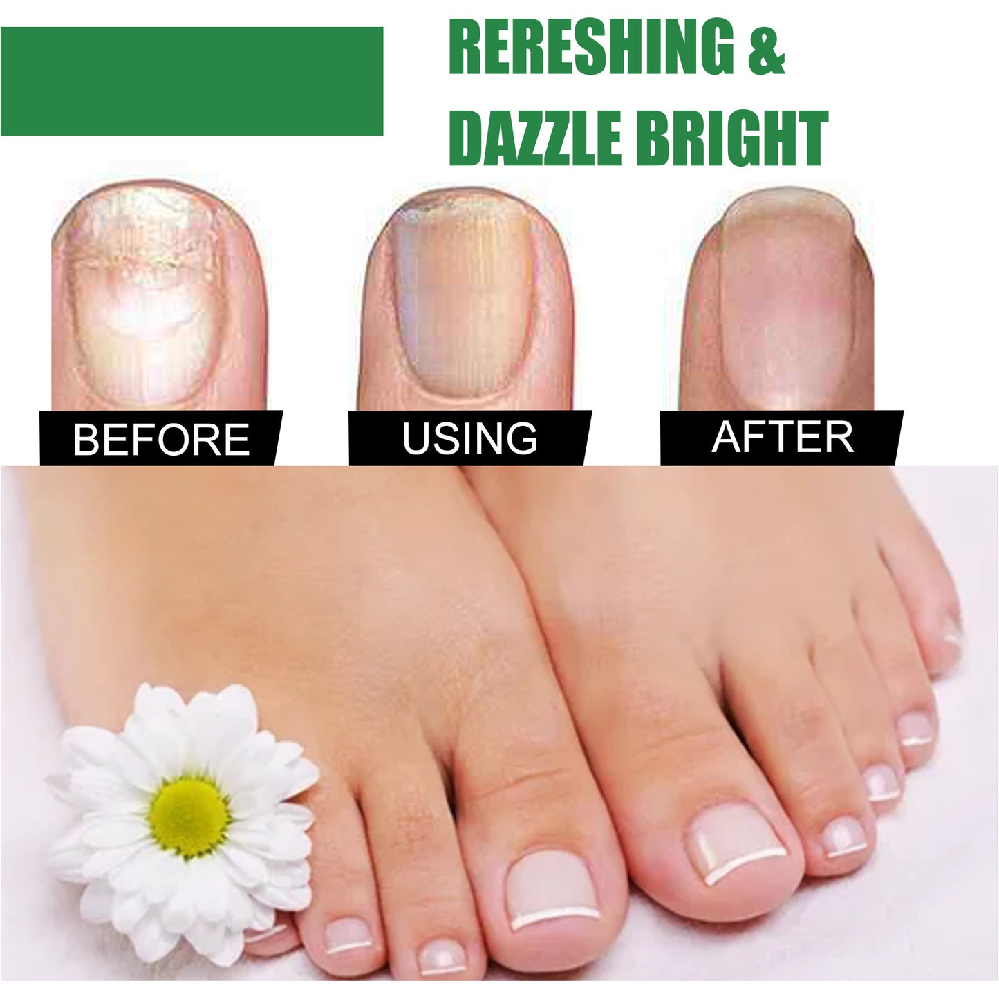 Foot Nail Tea Tree Oil Finger Thick Soft Nail Nutrition Hand And Foot Nail Care Solution