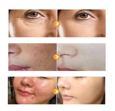 Non Hexapeptide Anti Wrinkle