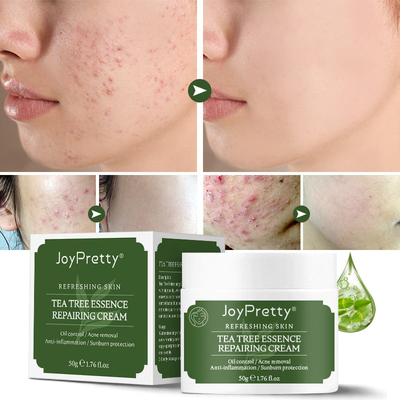 Tea Tree Oil Control Acne Moisturizing Moisturizing Cream