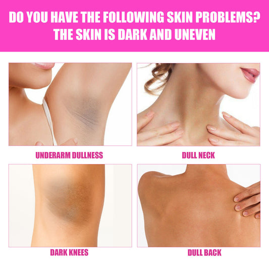 Elbow Private Part Skin Beauty Underarm Whitening Cream