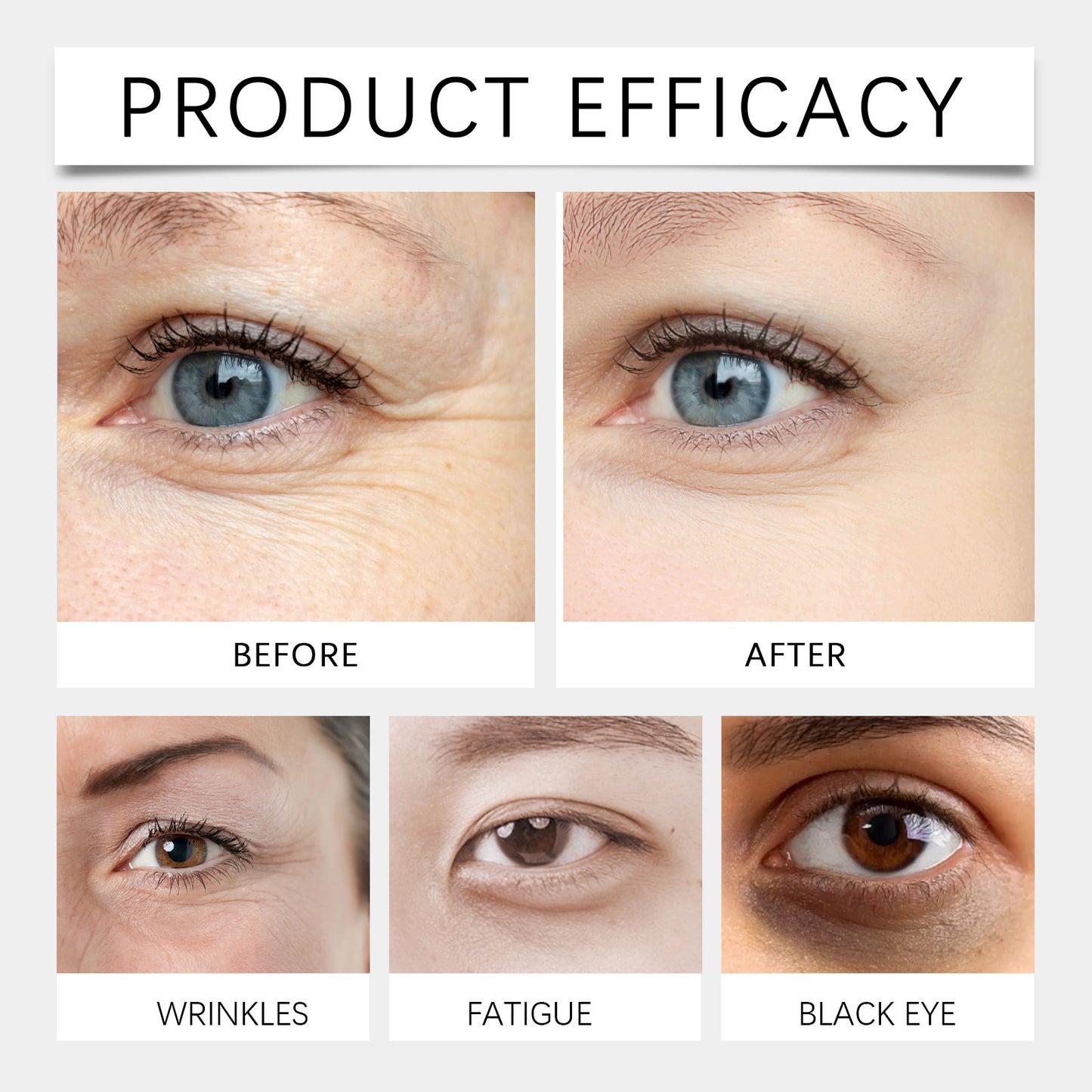 OUHOE Eye Peptide Cream, Moisturize And Moisturize The Skin Around The Eyes With A Massage Cream