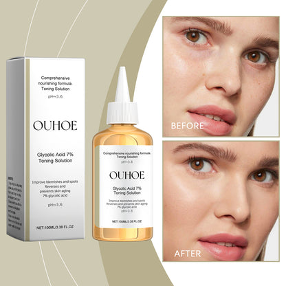 OUHOE Glycolic Acid 7% Moisturizing Toner, Remove Acne, Improve Skin Condition And Rejuvenate Skin Toner Essence