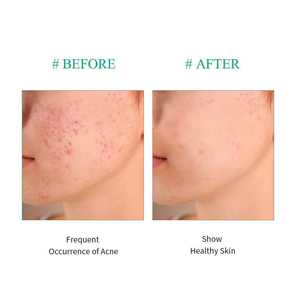 Simple Home Brightening Tea Tree Repair Liquid