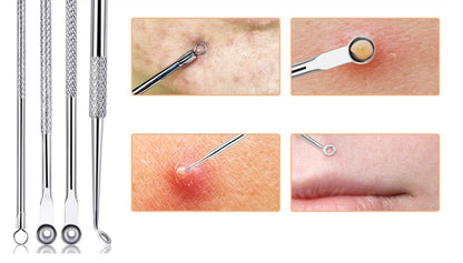 Stainless Steel Acne Needle Clip Double Head Beauty Tool Set