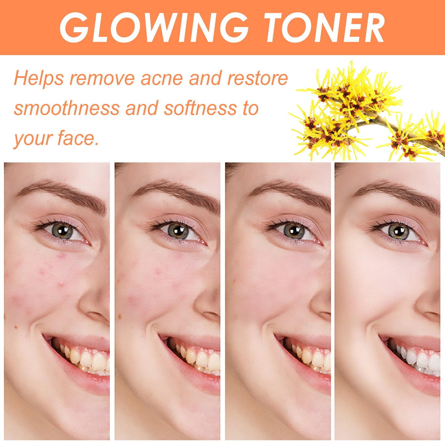 Salicylate Desalting Pimple Acne Marks Gentle And Clean