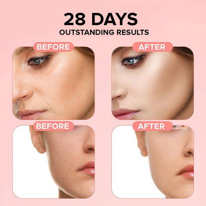 Nicotinamide Moisturizing And Nourishing Softening Skin
