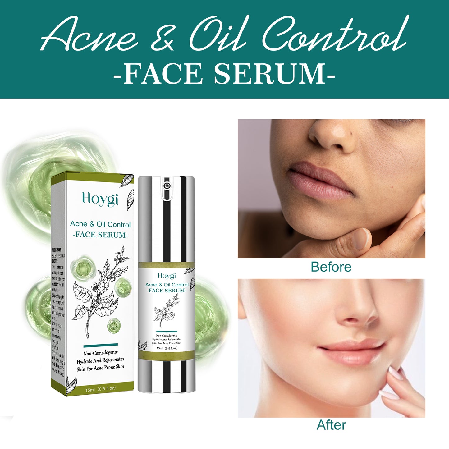 Hoygi Tea Tree Oil Facial Essence, Moisturize Whitening, Tighten Pores, Moisturize, Rejuvenate And Repair Essence