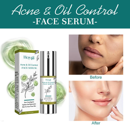Hoygi Tea Tree Oil Facial Essence, Moisturize Whitening, Tighten Pores, Moisturize, Rejuvenate And Repair Essence