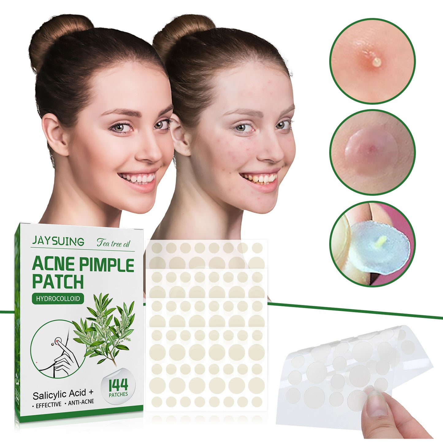Invisible Makeup, Waterproof, Moisturizing And Cleaning Tea Tree Oil Acne Patch