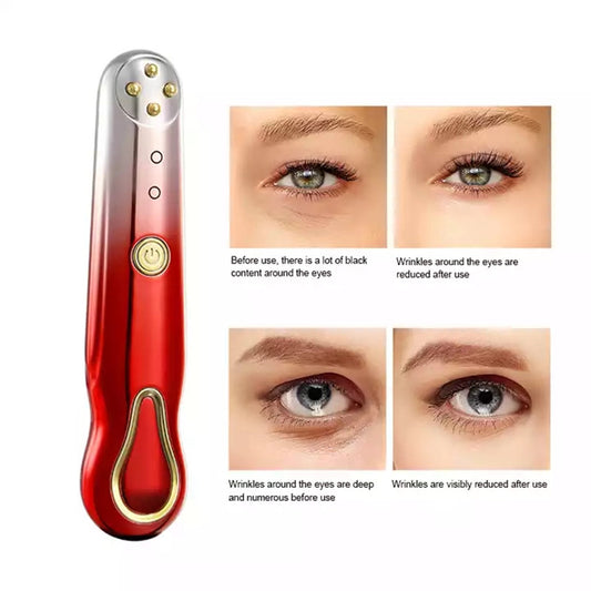 RF Radio Frequency Eye Massager Anti-Ageing Wrinkle Massager Portable Electric Device Dark Circle Facials Vibration Massage Pen