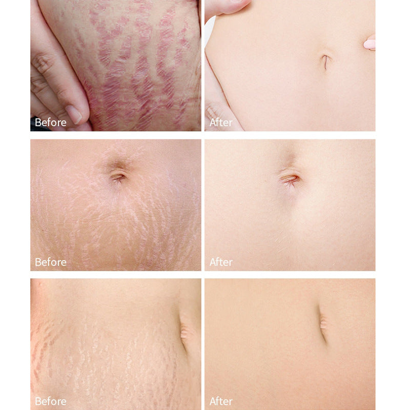 Vitamin E Liquid Moisturizes And Lightens Scars