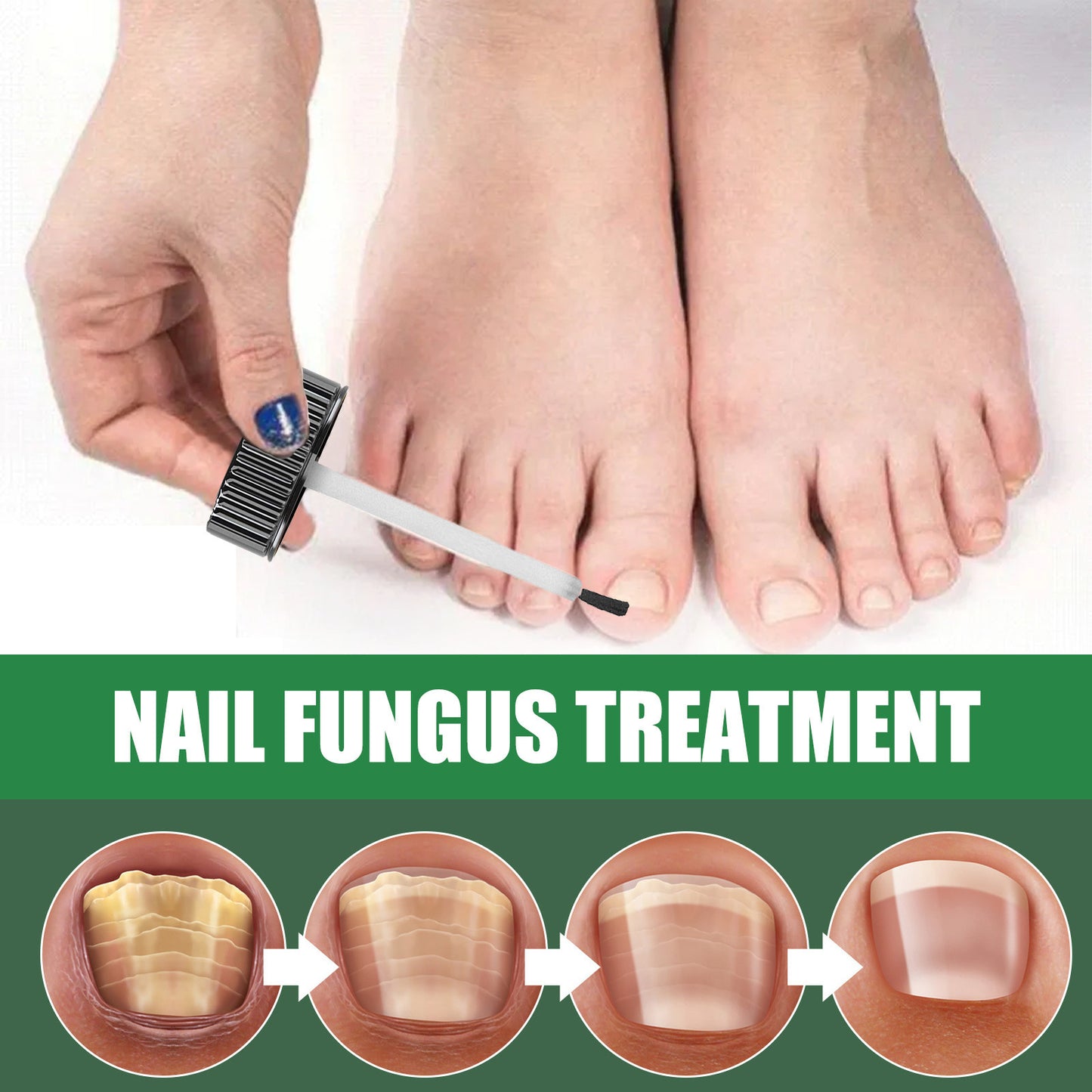 Foot Nail Tea Tree Oil Finger Thick Soft Nail Nutrition Hand And Foot Nail Care Solution