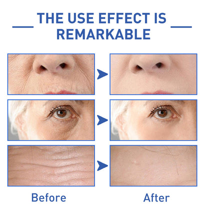 Water Light Cone Shell Peptide Anti-wrinkle