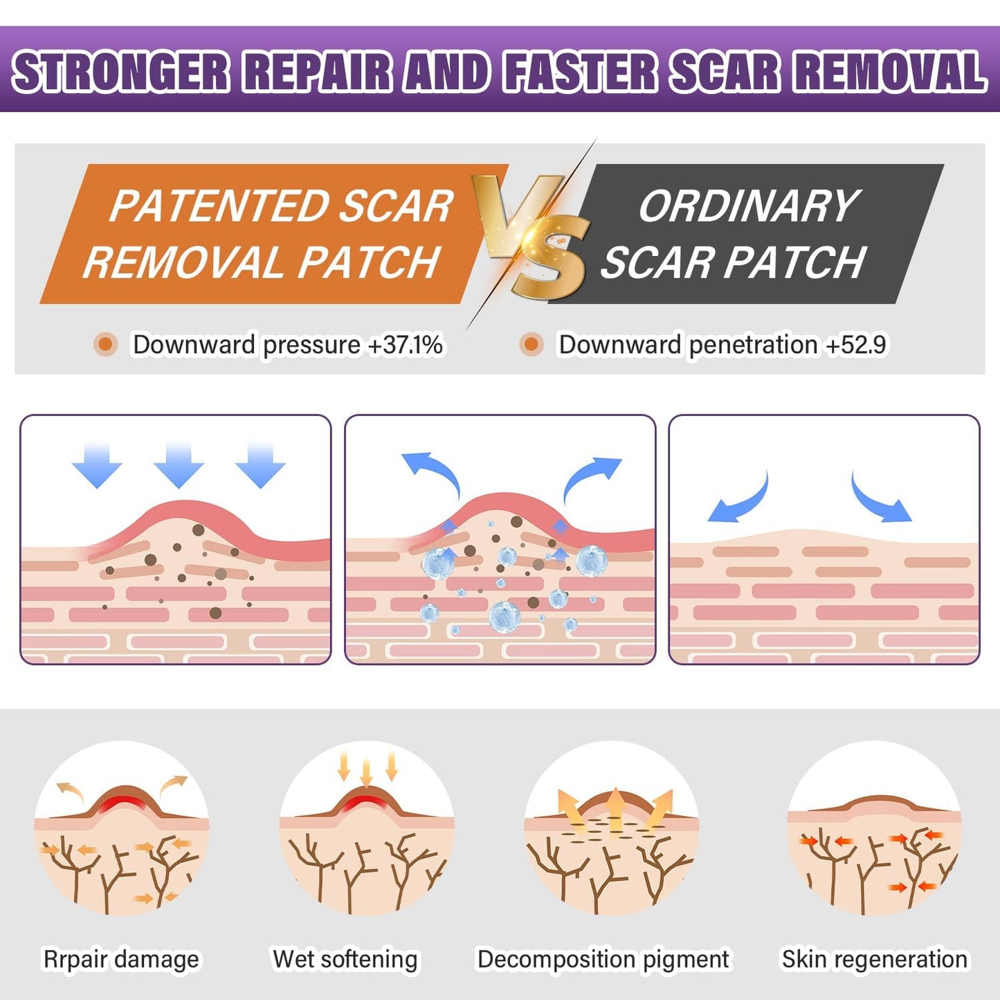 Scar Paster Silicone Scar Sheets15 M Length Soothing