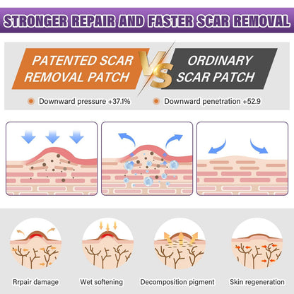 Scar Paster Silicone Scar Sheets15 M Length Soothing