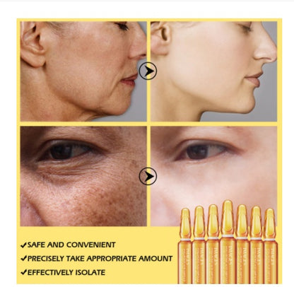 Non Hexapeptide Anti Wrinkle