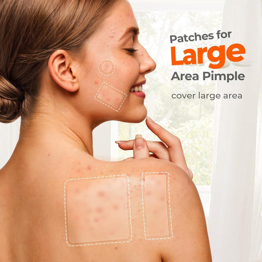 Acne Cover Patch Mild Desalting PIMPLE Acne Closed Mouth