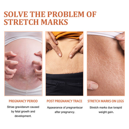 Scar Repair Smooth Skin Rejuvenation Neck Cream