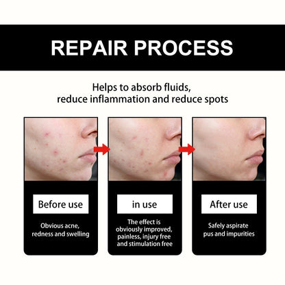 Cute Black Acne Cover Patch Reduces Spots