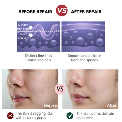 Retinol Tightening Plastic Activating Cream