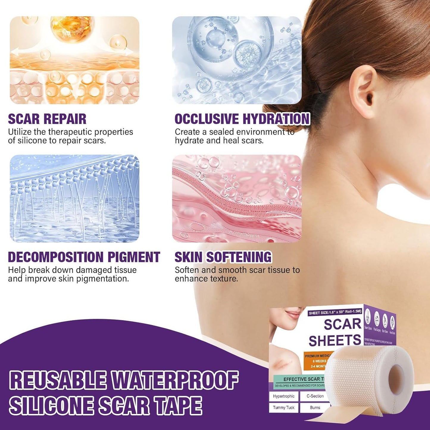 Scar Paster Silicone Scar Sheets15 M Length Soothing