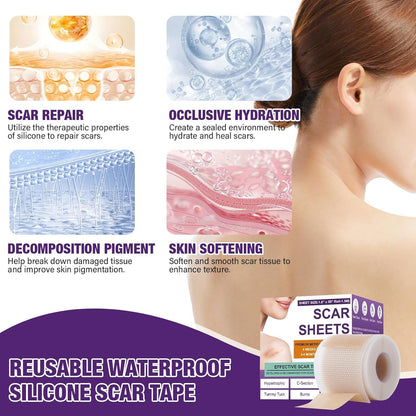Scar Paster Silicone Scar Sheets15 M Length Soothing