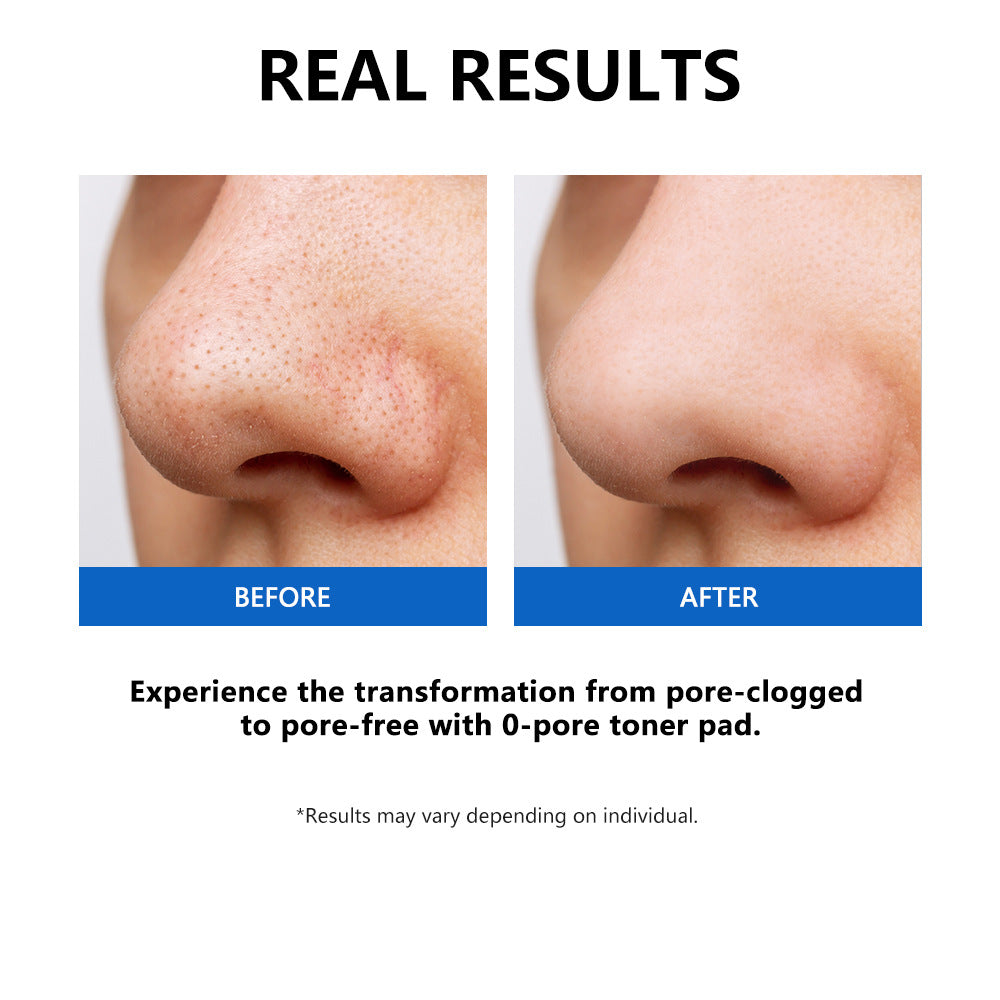 Zero Pores Salicylic Acid Cotton Pieces Facial Care