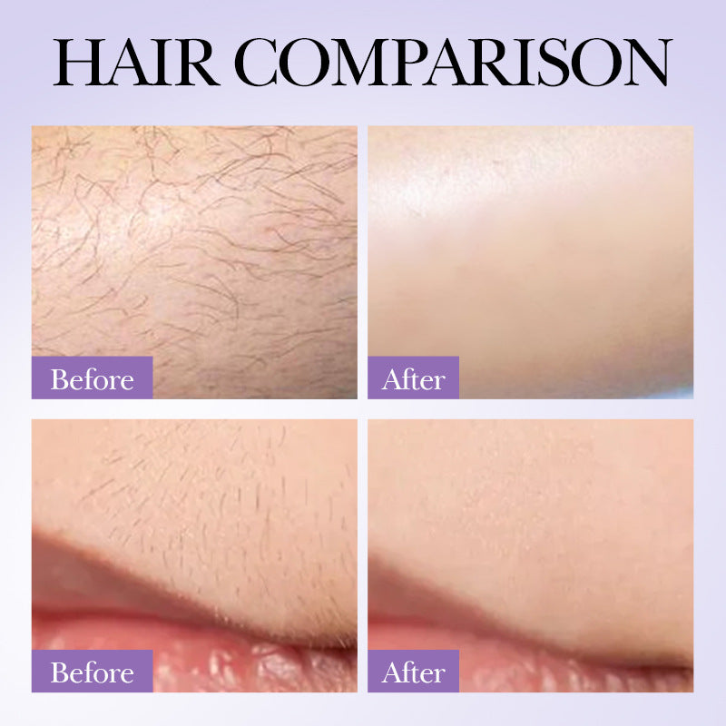 Hair Growth Inhibition Armpit Leg Hair Spray