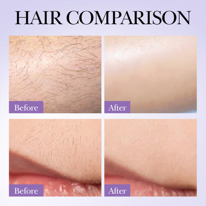 Hair Growth Inhibition Armpit Leg Hair Spray