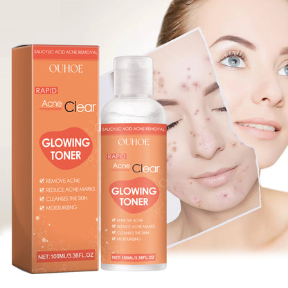Salicylate Desalting Pimple Acne Marks Gentle And Clean